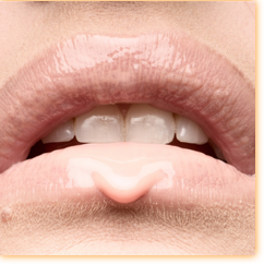 Perla / Maarek / Hopen Art
(Base)